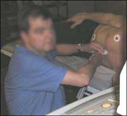 Cardiac scanning without a height adjustable table and chair forces the sonographer to lift the arms away from the body.