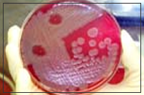 Disease Agents and Toxins Specific Pages