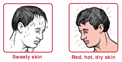  two Pictures of showing symptoms of heat stroke