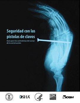 image of an xray showing a hand with a nail in it